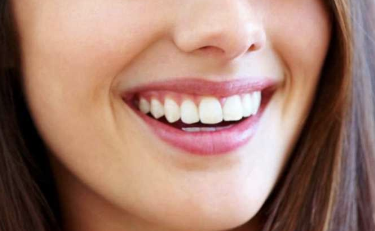 Healthy teeth