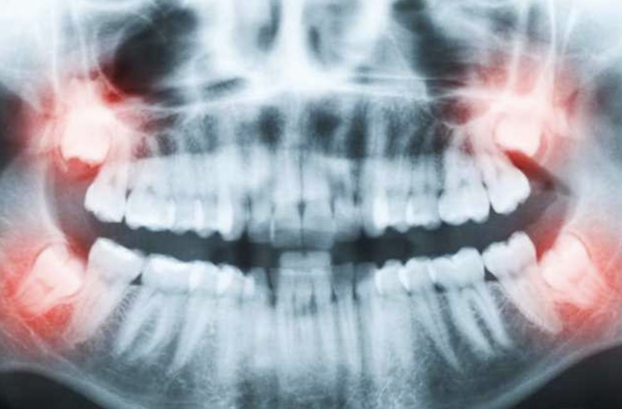 dental xray