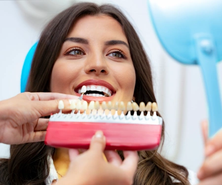 Dentist using a shade guide to match the patient's tooth color
