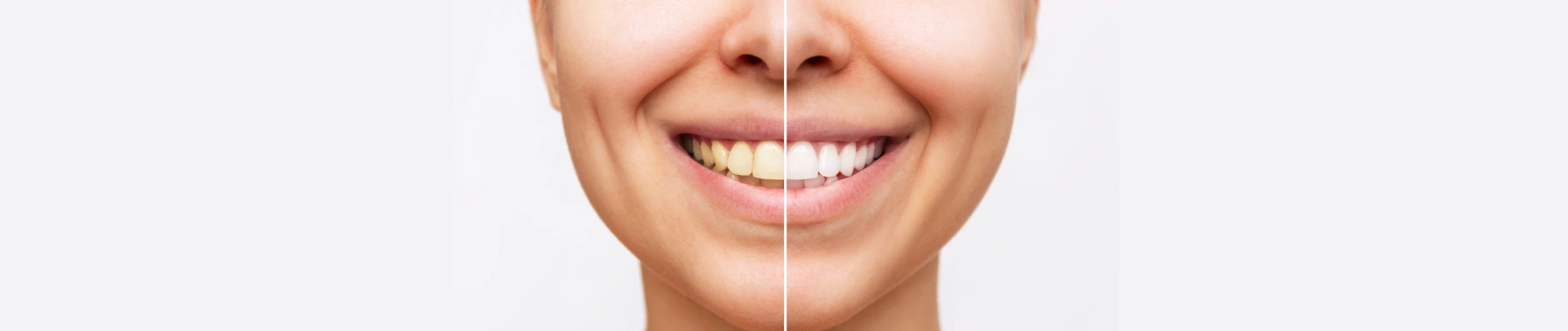 Close-up of a smiling mouth showing healthy teeth